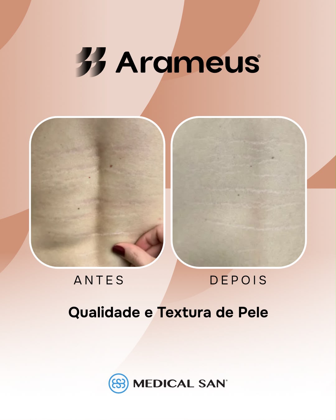 Antes e depois da qualidade e textura da pele
